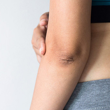 Elbow joint Elbow joint